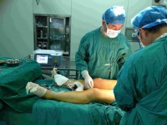 Medical diode laser system protable图3